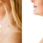9 Ways To Get Rid Of Neck Fat (That Aren’t Surgery)